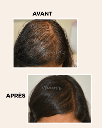 SPRAY POUSSE